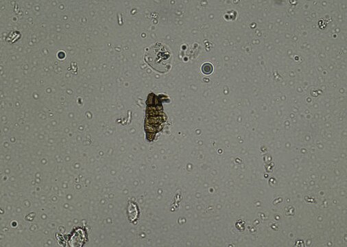 soil microorganisms under a microscope including amoeba, flagellates, nematodes, fungi, bacteria	