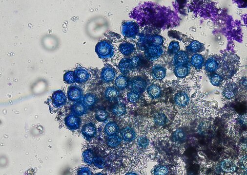 soil microorganisms under a microscope including amoeba, flagellates, nematodes, fungi, bacteria	