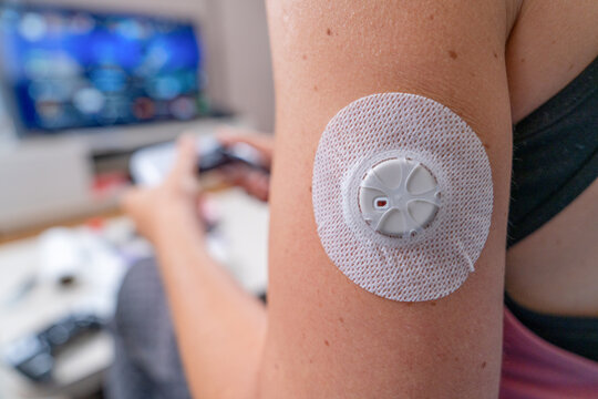 A continuous glucose monitor sensor is attached to a womans upper arm while she plays a video game in the blurred background, a concept of diabetes management technology.