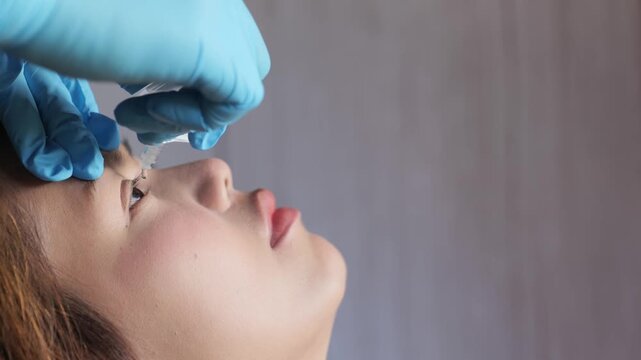 Close-up of a doctor's gloved hand applying eye drops or artificial tears into a woman's eye, medical eye care treatment, ophthalmology examination and eye health concept.