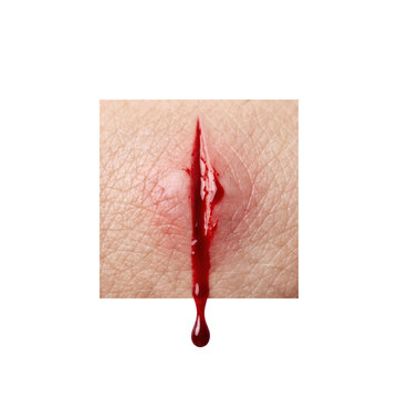 Realistic open wound skin laceration with dripping blood