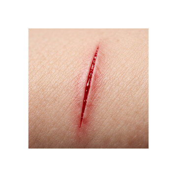 Fresh linear cut wound with red blood on human skin