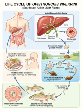Scientific infographic diagram illustrating the life cycle of Opisthorchis viverrini (Southeast Asian liver fluke).