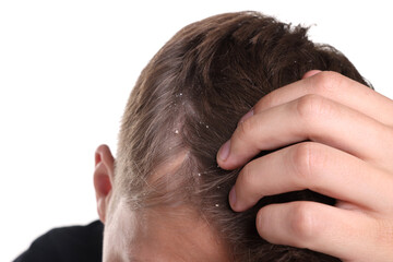 Fototapeta premium Dandruff problem. Man examining his head on white background, closeup