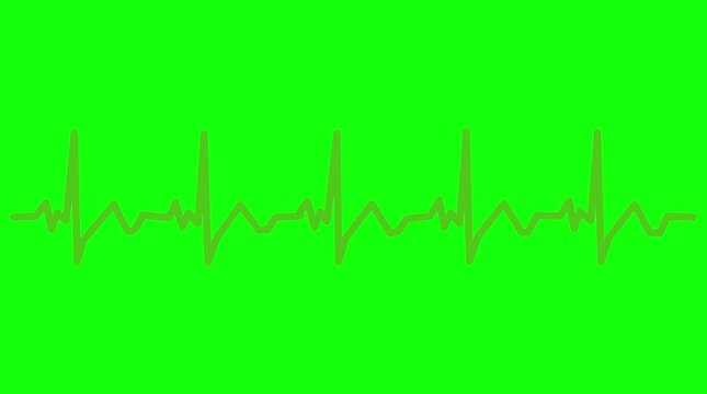 Animated Heartbeat Line ECG Pulse Waveform Flatlining on Green Screen Chroma Key Background Overlay