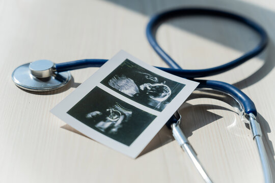 Photo: Ultrasound screening of a child and stethoscope. Image of an embryo.