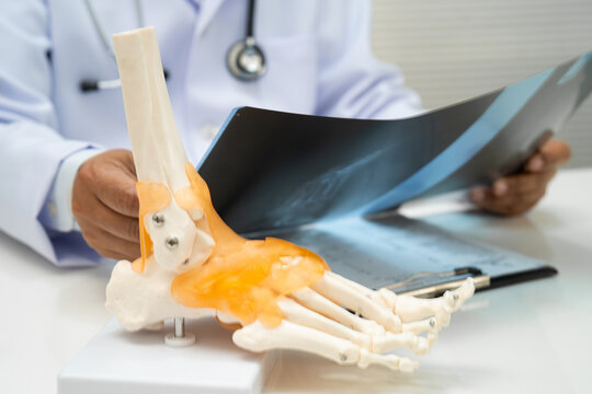 Doctor examining foot ankle  joint bone radiography xray film.