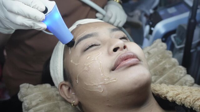 Female patient receiving dual radiofrequency and ultrasound facial treatment at an aesthetic clinic for skin tightening. Currently on forehead.