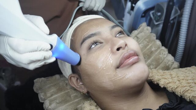Female patient receiving dual radiofrequency and ultrasound facial treatment on the cheeks at an aesthetic clinic for skin tightening. Currently on forehead.