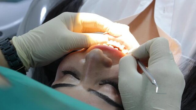 A Hispanic woman dentist in uniform and glasses is performing a dental procedure using floss and cotton on a patient's teeth inside a dental office in Neiva, Huila, Colombia. Concept of dental surgery