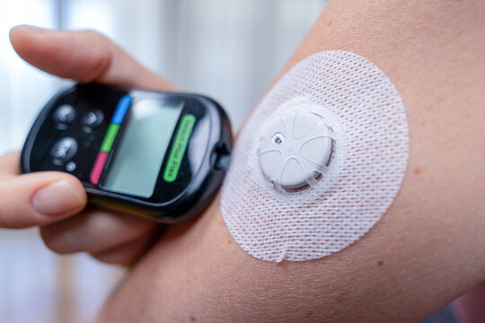 A hand holds a black glucose monitor device beside a white sensor patch attached to the upper arm, demonstrating diabetes management technology for blood sugar tracking.