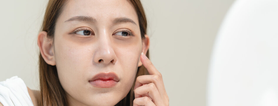 lack of sleep problem,  Worried Asian young woman pointing finger at dark circles under her eyes