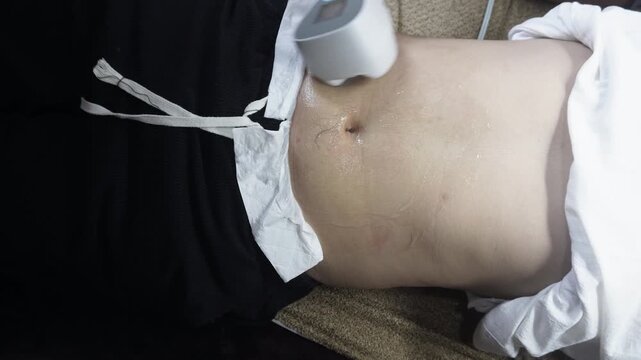 Non-invasive radio frequency body contouring treatment on the abdomen of a male client. Using an RF applicator for skin tightening and body sculpting in an aesthetic clinic.