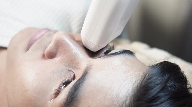 Closeup of a young man receiving a 2D HIFU facial session in an aesthetic clinic for noninvasive skin tightening and rejuvenation.