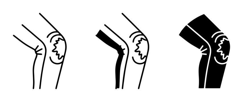 Knee Joint Pain Icons, Arthritis and Injury Vector Illustrations, Medical Health Symbols