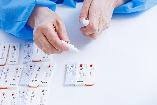Doctor hands holding reagent dropper above rapid express test cassettes for hiv and hepatitis