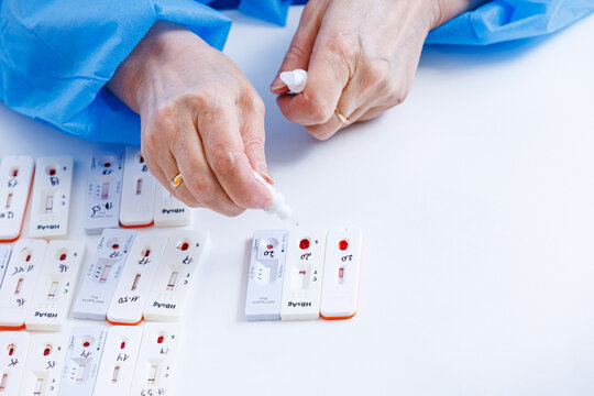 Doctor dripping buffer reagent solution onto rapid test cassettes for hiv diagnosis