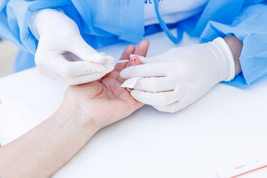 Nurse collecting capillary blood sample from patient finger with capillary tube