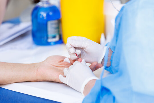 Nurse collecting capillary blood sample from patient finger with pipette for medical test
