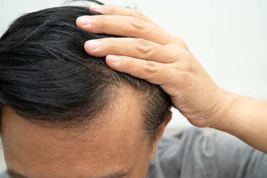 Bald in the middle head and begin no loss hair glabrous of mature Asian business smart active office man.