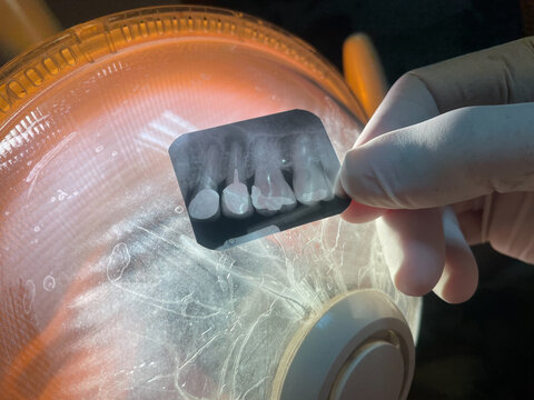 A professional dentist wearing a white glove holds a dental x-ray film sheet showing teeth structure up to an orange light indicator for diagnosis and examination in a dental clinic.