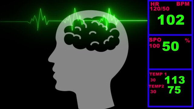 Medical monitor display shows a human head silhouette with active brain waves alongside vital signs like heart rate and pulse on a dark background.