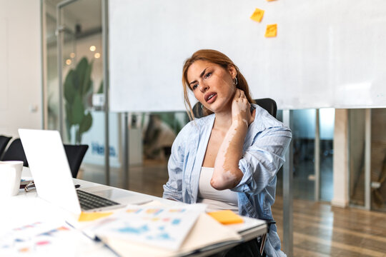 Neck pain. Upper body discomfort, Office worker with muscle strain, Healthcare and ergonomics concept. Stressed woman sitting at desk and holding painful neck with hand in modern workplace.