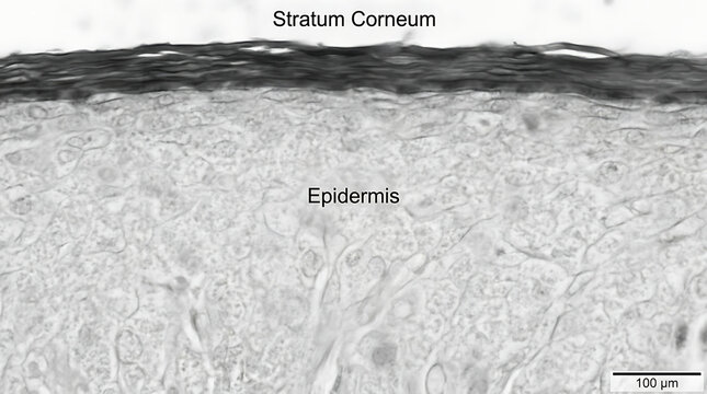 Microscopic view of human skin tissue showing the epidermis layer and the outer stratum corneum cell structure