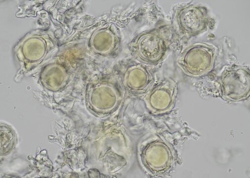 soil microorganisms under a microscope including amoeba, flagellates, nematodes, fungi, bacteria	