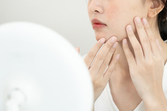 Young woman asian are worried about faces Dermatology and allergic to steroids in cosmetics. sensitive skin, red face from sunburn, acne, allergic to chemicals, rash on face. skin problems and beauty