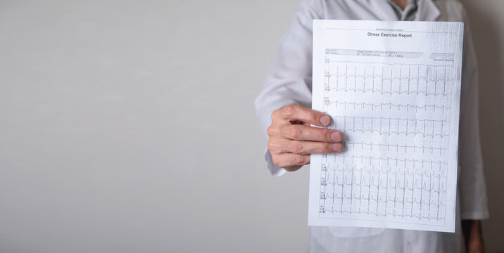 Doctor holding ECG results graph. Health and medicine