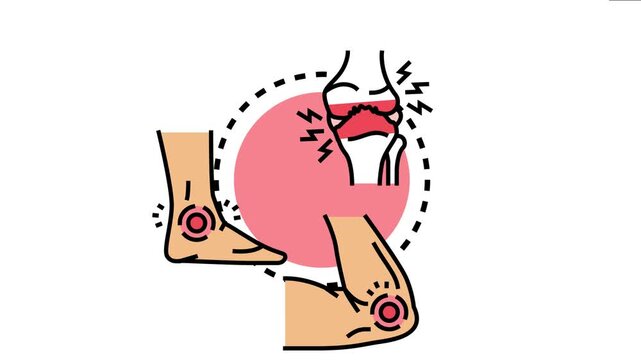 Joint pain impacting various body parts including knee, elbow, and ankle, the common symptoms of arthritis and related medical conditions