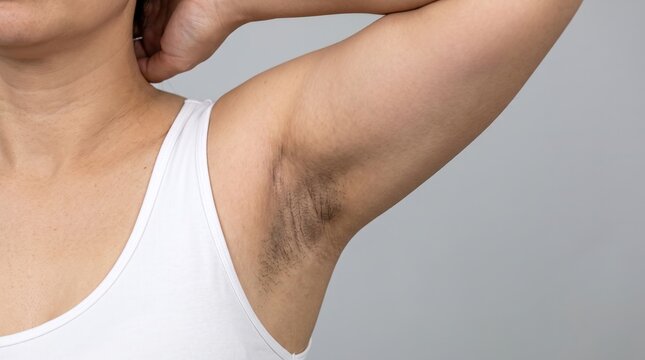 Close up view of female armpit showing hyperpigmentation dark skin fold and unwashed hair stubble
