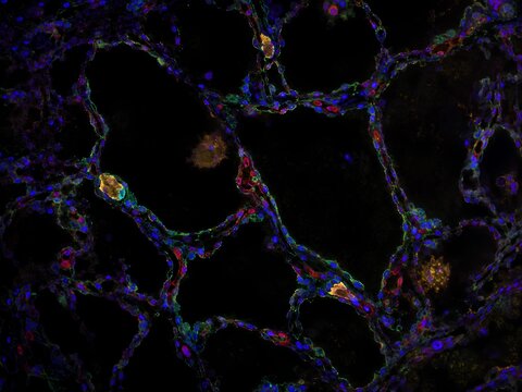 Human lung alveoli and capillary barrier fluorescence visualization