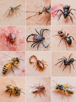  various insect bites and stings on human skin, 