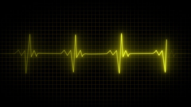A glowing yellow ekg heart rate monitor line displaying a rhythmic pulse pattern across a dark, grid-lined background, representing medical diagnostic technology and cardiovascular health
