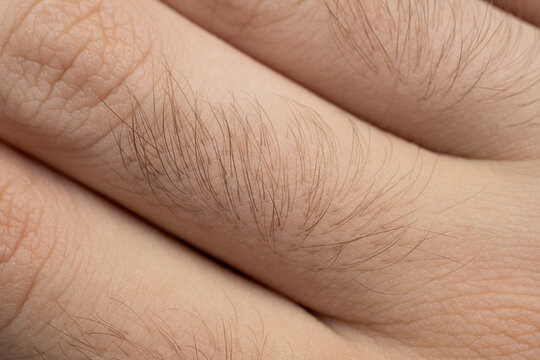 Hairy human skin, close view of male arm or leg, body hair, natural fur pattern