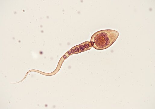 Microscopic view of a human sperm cell with its distinct head and tail
