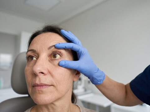 Physician Examining Yellow Sclera in Patient With Jaundice, Clinical Eye Examination for Liver Disease and Icterus