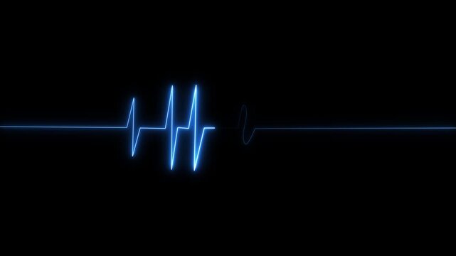 Red EKG flat line. Cardiogram pulse monitor showing heart attack emergency or cardiac arrest. Medical device animation.