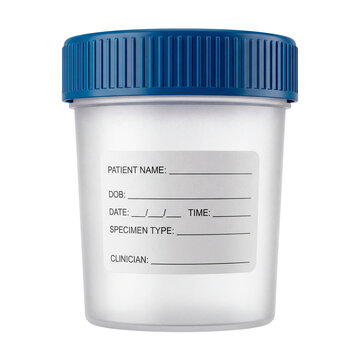 Medical specimen container with blue cap isolated on a white and transparent background. Healthcare equipment.