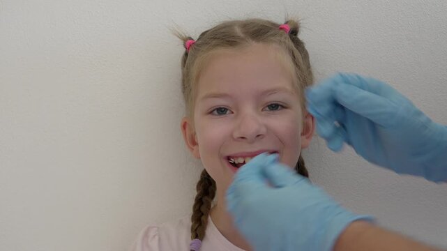 ​Step-by-step process of orthodontist applying reverse pull headgear facemask on smiling little girl for underbite correction