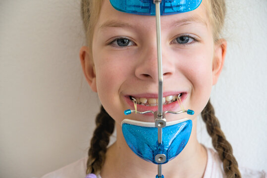 Close up portrait of young girl wearing orthodontic facemask and elastics on teeth
