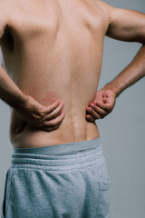 Naklejka premium A man with a summer tan massages his sore lower back with his fingers. A guy in gray shorts, turning away from the camera, scratches his pimply back. men's health: prevention of spinal diseases