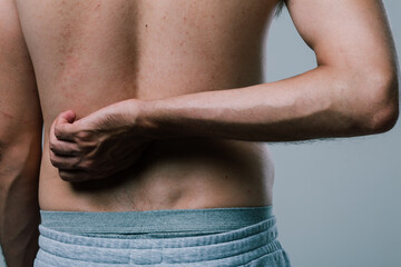 Naklejka premium A man with a summer tan massages his sore lower back with his fingers. A guy in gray shorts, turning away from the camera, scratches his pimply back. men's health: prevention of spinal diseases
