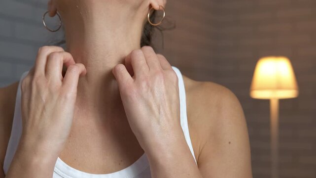 Woman with itchy skin scratching her neck. Unrecognizable woman scratching her neck and shoulders, suffering from an allergic reaction, hives, or insect bites