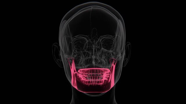 Bruxism is a condition characterized by involuntary teeth grinding or jaw clenching, often associated with jaw muscle tension, tooth wear, and temporomandibular joint stress | Indication Video