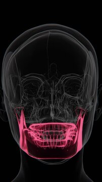 Bruxism is a condition characterized by involuntary teeth grinding or jaw clenching, often associated with jaw muscle tension, tooth wear, and temporomandibular joint stress. | Red indication video