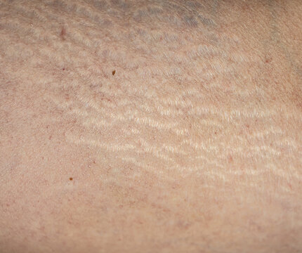 Close-up of human skin with visible wrinkles