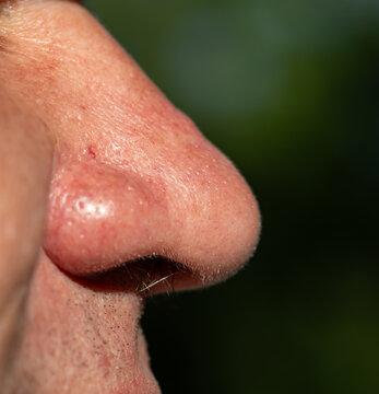 Close-up of human nose in profile